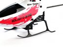 Xtreme Landing Skid w/ Battery Mount (Solo Pro 270)